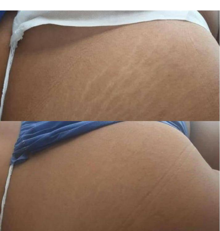 Paramedical Tattoo Training