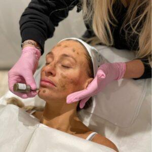 Bio Microneedling Training