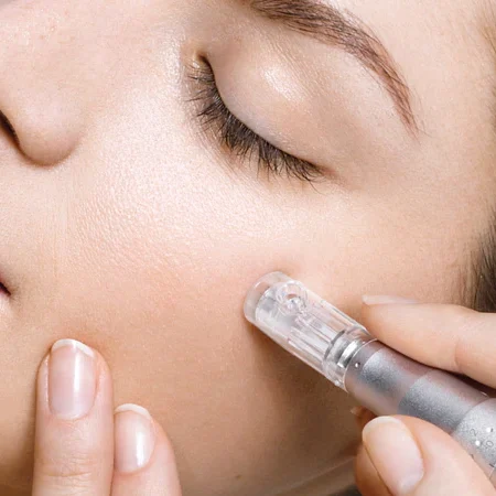 microneedling1_600x600