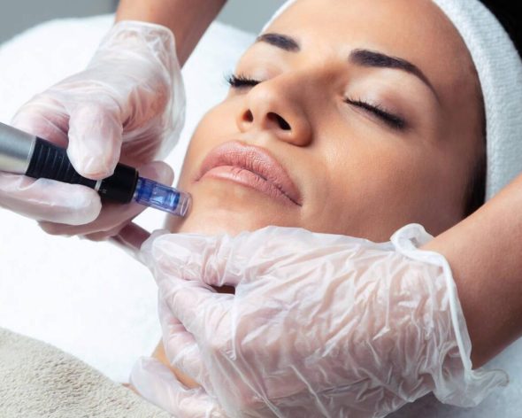 Microneedling Training