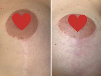 paramedical tattoo 02